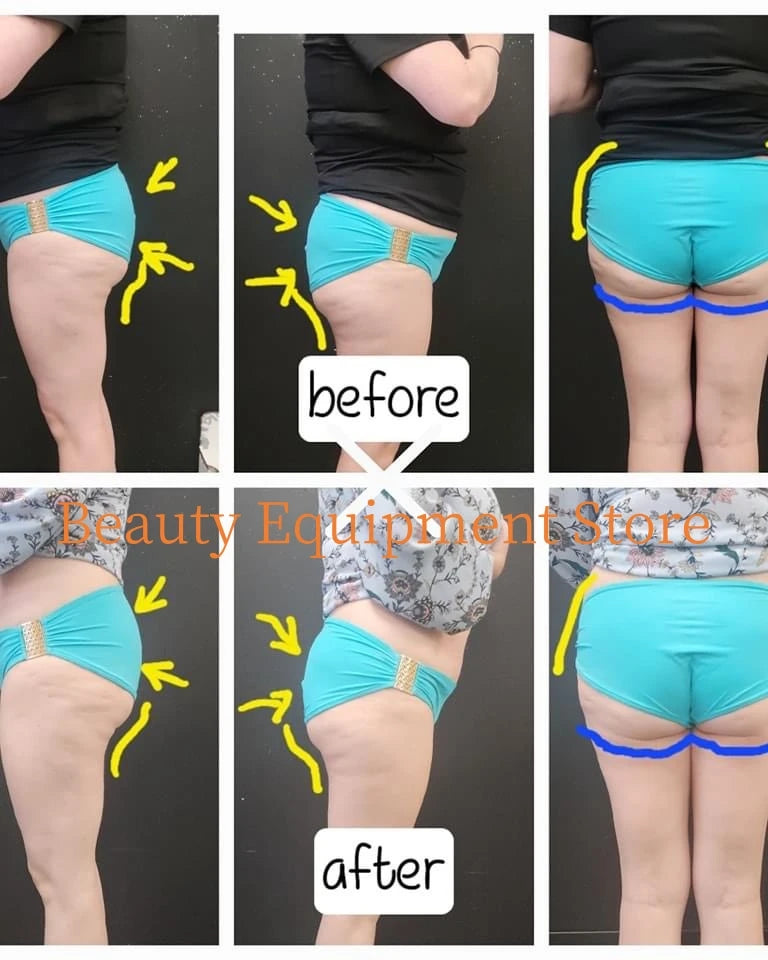 Professional EMS Body Sculpt Machine Fat Burner Body Slimming Muscle Stimulation Therapy with 4 Handles